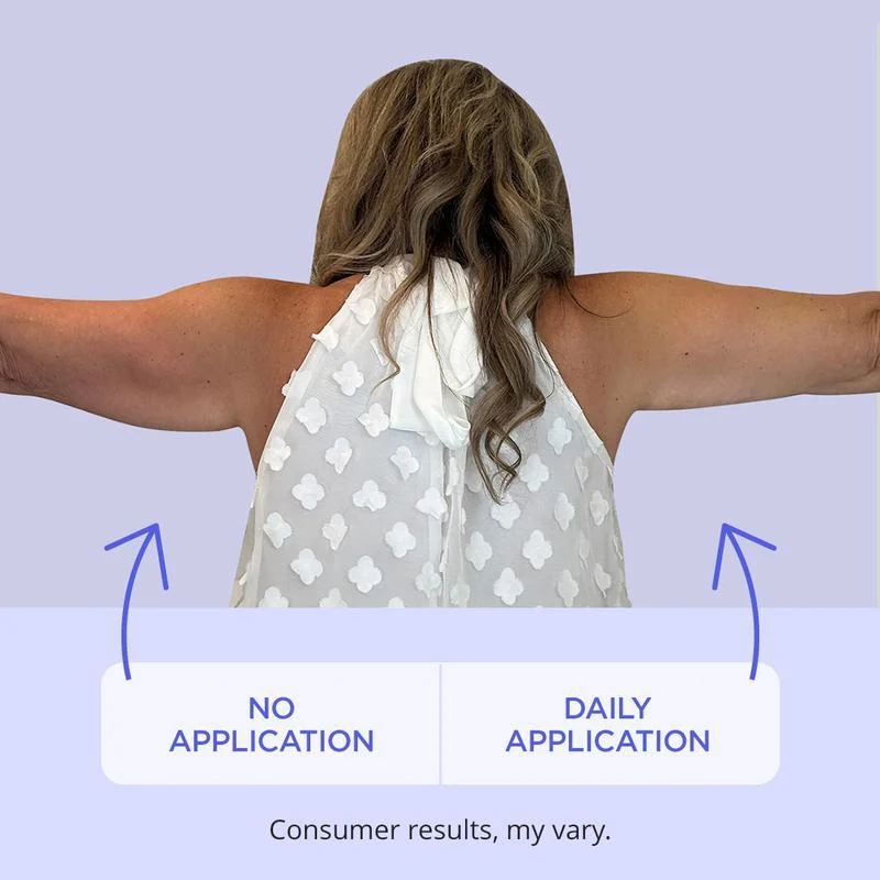 arm firming cream tightens lifts sagging skin protight complex spu895851308957 desc 5