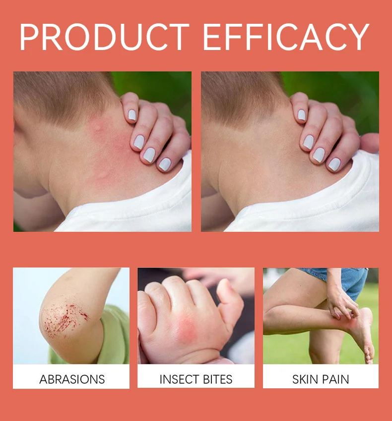 SIIMUNANA Drawing Salve All-in-One Soothing Ointment for Quick Relief from Insect Bites & Skin Irritation 13 siimunana drawing salve all in one soothing ointment spu875133673185 desc 13